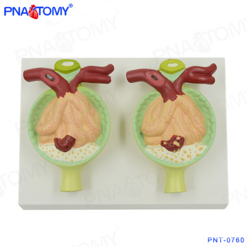 PNT-0760 urine protein kidney anatomical model